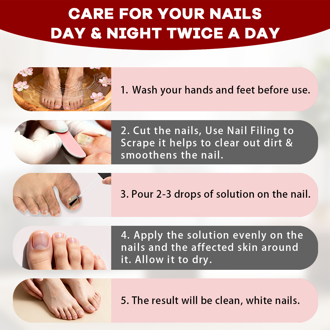 SOVS Toenail Fungus Treatment Extra Strength ,Antifungal Solution ,Triple Action Formula for Damaged Nails, Multi-Purpose Nail Repair,1 Fl Oz Manicure Therapy