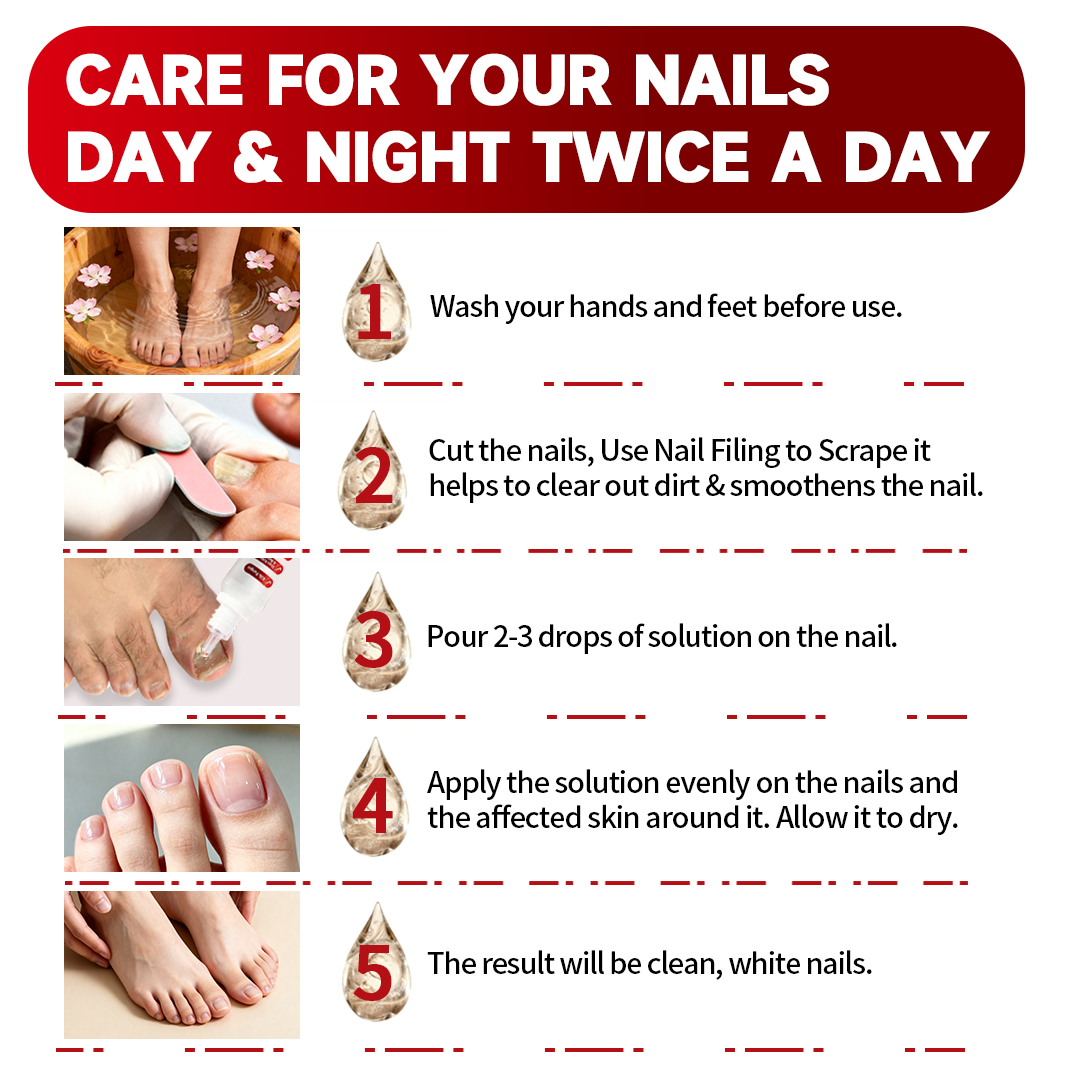 SOVS Toenail Fungus Treatment Extra Strength, Antifungal Solution for Toenail or Fingernail, Triple Action Formula for Remove Fungal, Repair and Renewal Damaged Nails, 0.5 Fl Oz