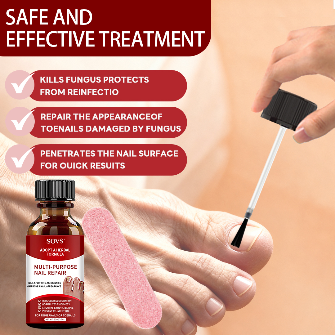 SOVS Toenail Fungus Treatment Extra Strength ,Antifungal Solution ,Triple Action Formula for Damaged Nails, Multi-Purpose Nail Repair,1 Fl Oz Manicure Therapy