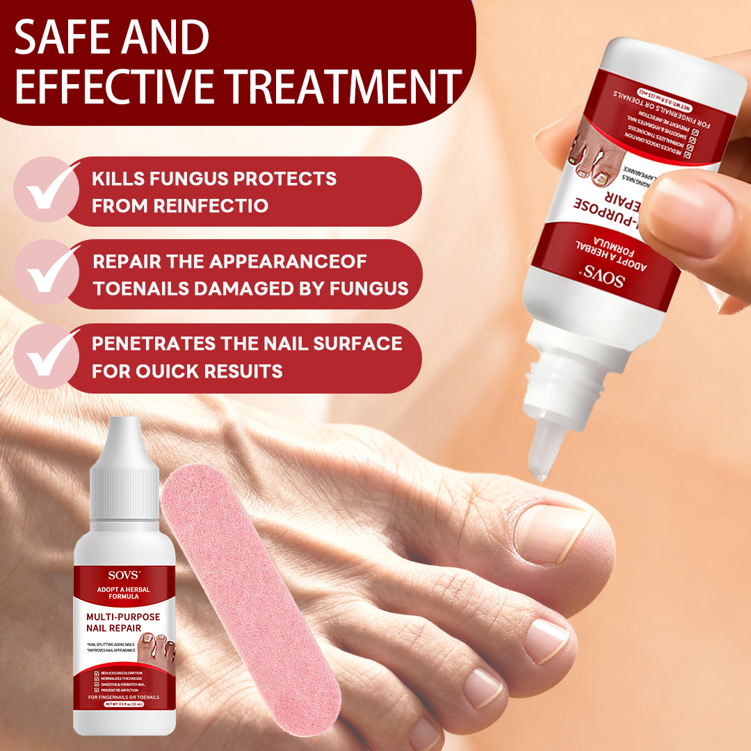 SOVS Toenail Fungus Treatment Extra Strength, Antifungal Solution for Toenail or Fingernail, Triple Action Formula for Remove Fungal, Repair and Renewal Damaged Nails, 0.5 Fl Oz