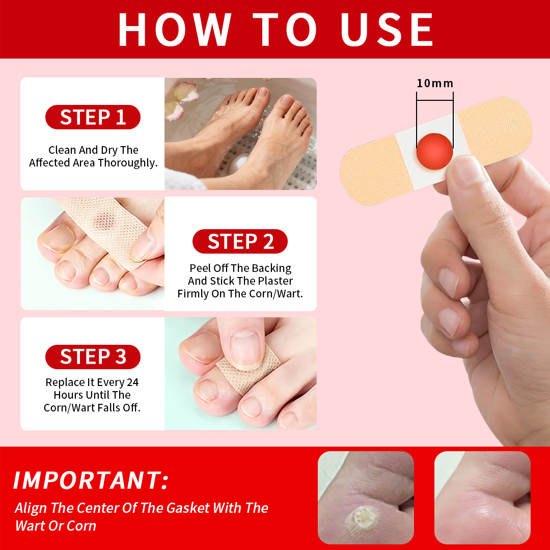 DERMFREE Wart & Corn Remover Pads - One Step Topical Pads