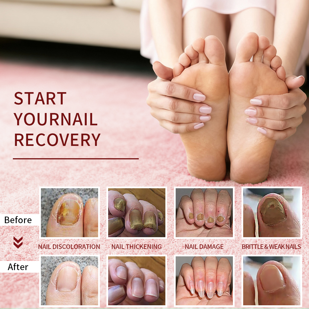 Nail Care Nourishes Oil Pen, Nailgrowthoil for Fingernail, Moistens And Protects Nails And Nails With Anti-Dead Skin Barbs,Rose flavor