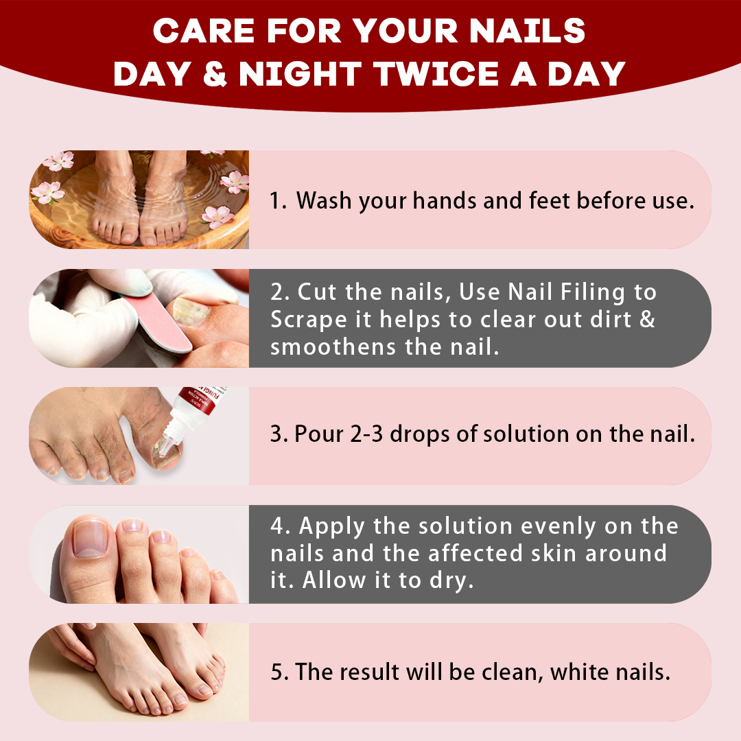 SOVS Toenail Fungus Treatment Extra Strength, Antifungal Solution for Toenail or Fingernail, Triple Action Formula for Remove Fungal, Repair and Renewal Damaged Nails, 0.5 Fl Oz