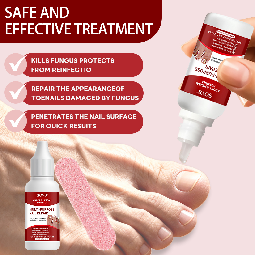 SOVS Toenail Fungus Treatment Extra Strength, Antifungal Solution for Toenail or Fingernail, Triple Action Formula for Remove Fungal, Repair and Renewal Damaged Nails, 0.5 Fl Oz