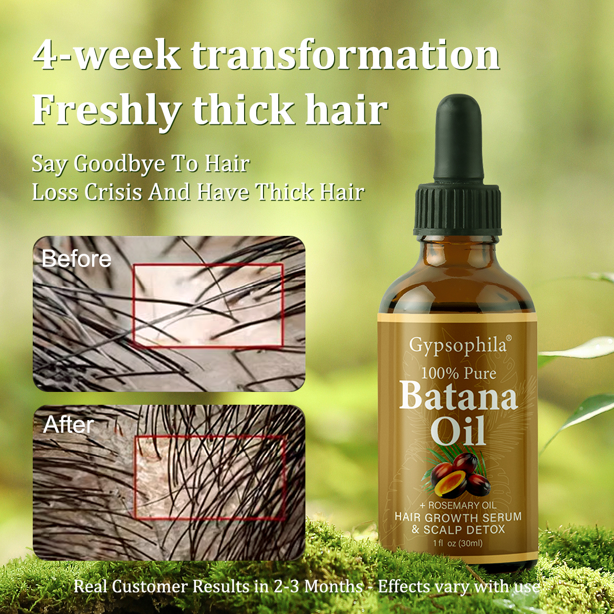 Gypsophila Batana Oil with Rosemary for Hair Growth - Nourish & Detox Scalp, Reduce Hair Loss, Strengthen & Promote Healthy Hair for Men & Women Organic Batana Oil(30mL)