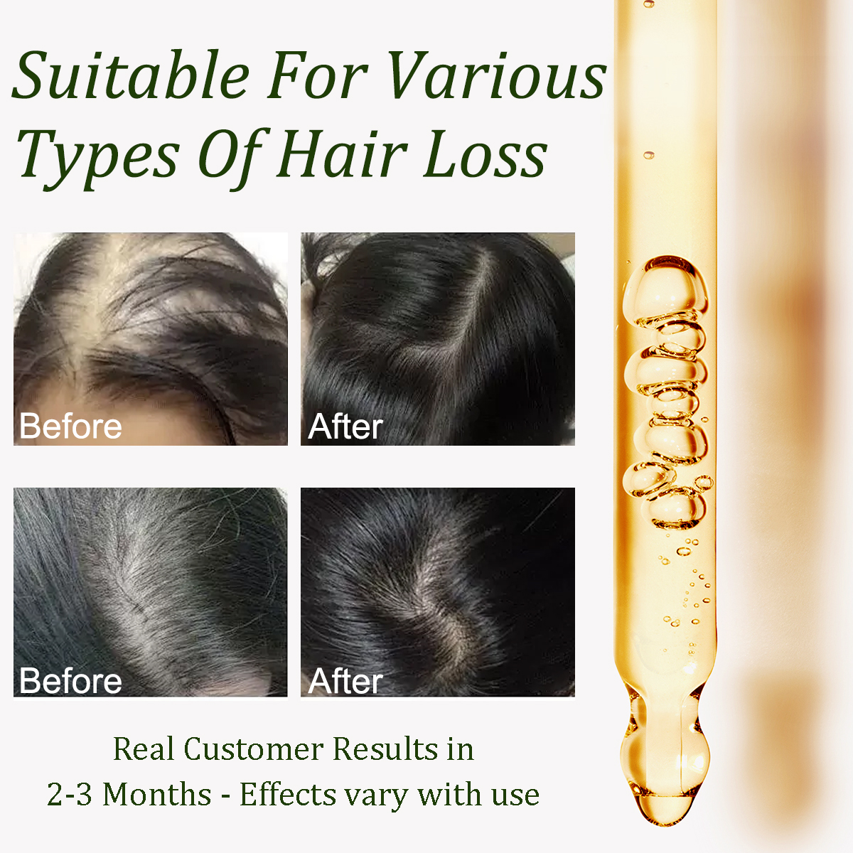 Gypsophila Batana Oil with Rosemary for Hair Growth - Nourish & Detox Scalp, Reduce Hair Loss, Strengthen & Promote Healthy Hair for Men & Women Organic Batana Oil(30mL)