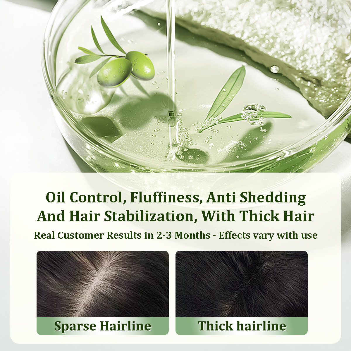 Gypsophila Batana Oil with Rosemary for Hair Growth - Nourish & Detox Scalp, Reduce Hair Loss, Strengthen & Promote Healthy Hair for Men & Women Organic Batana Oil(30mL)