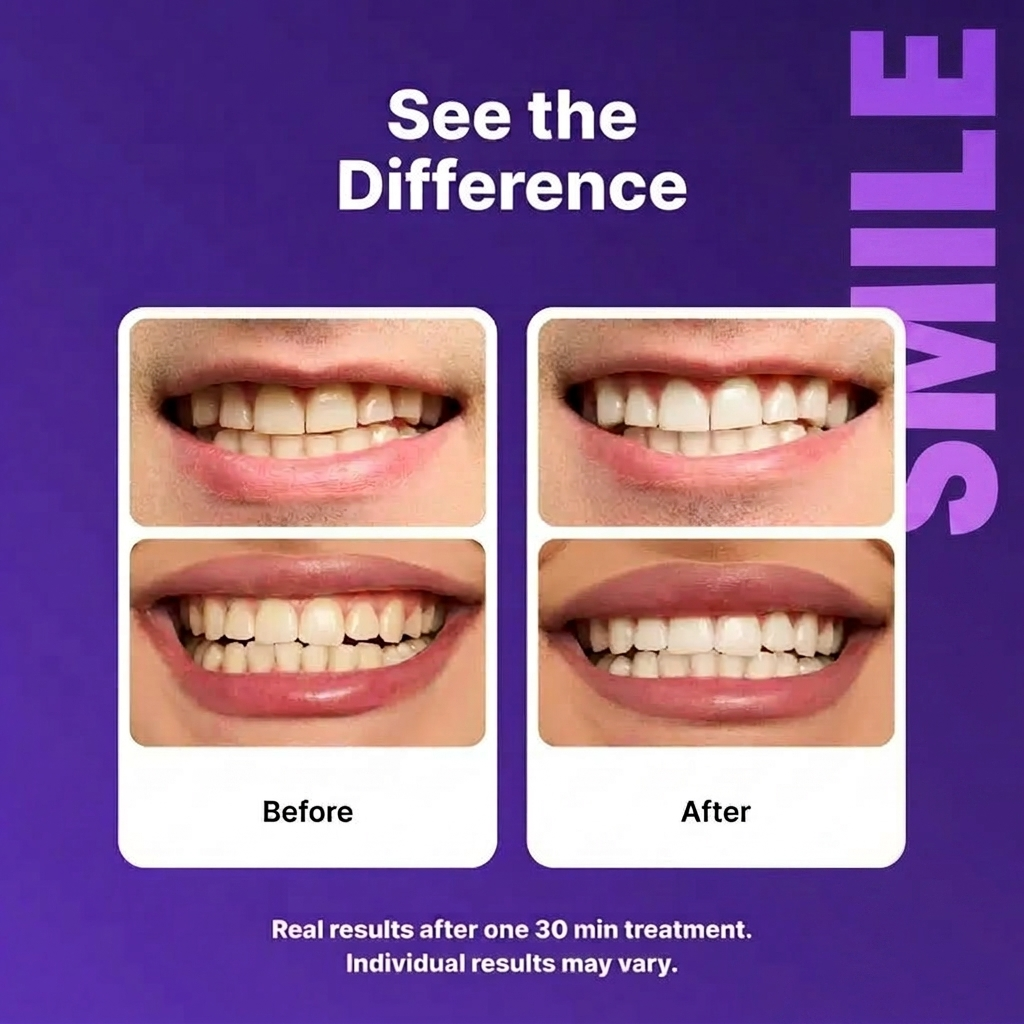 Purple Whitening Strips