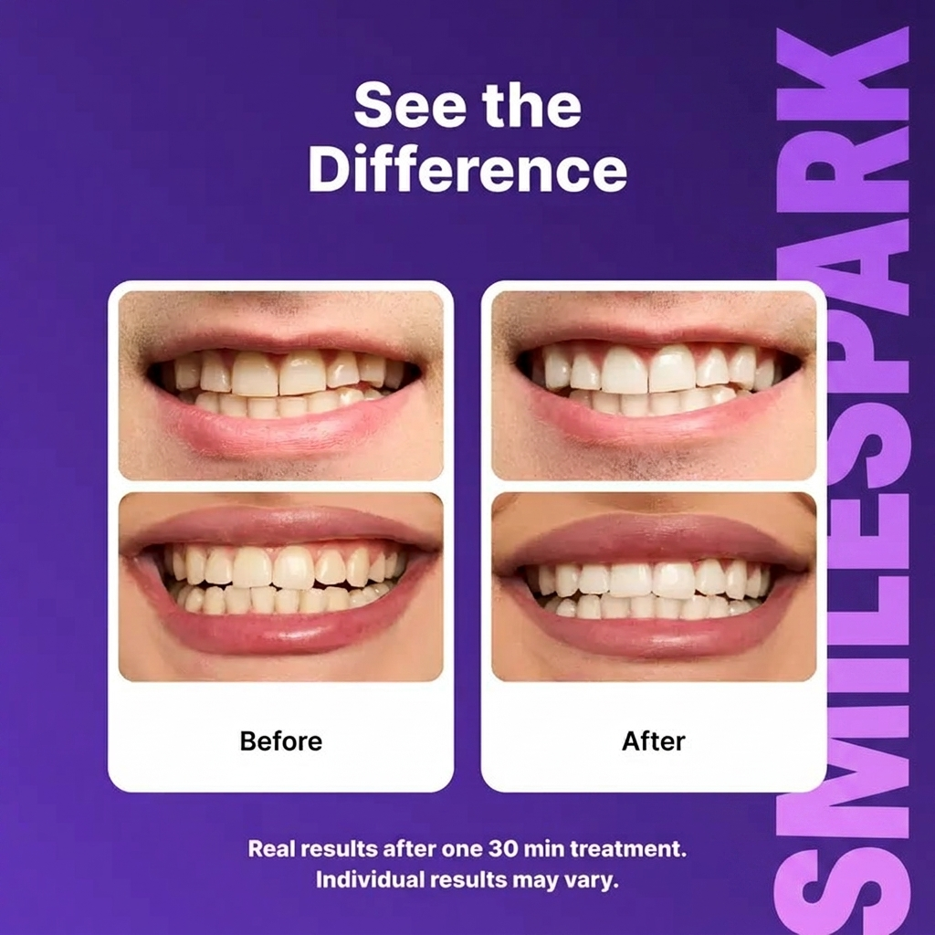 Purple Whitening Strips