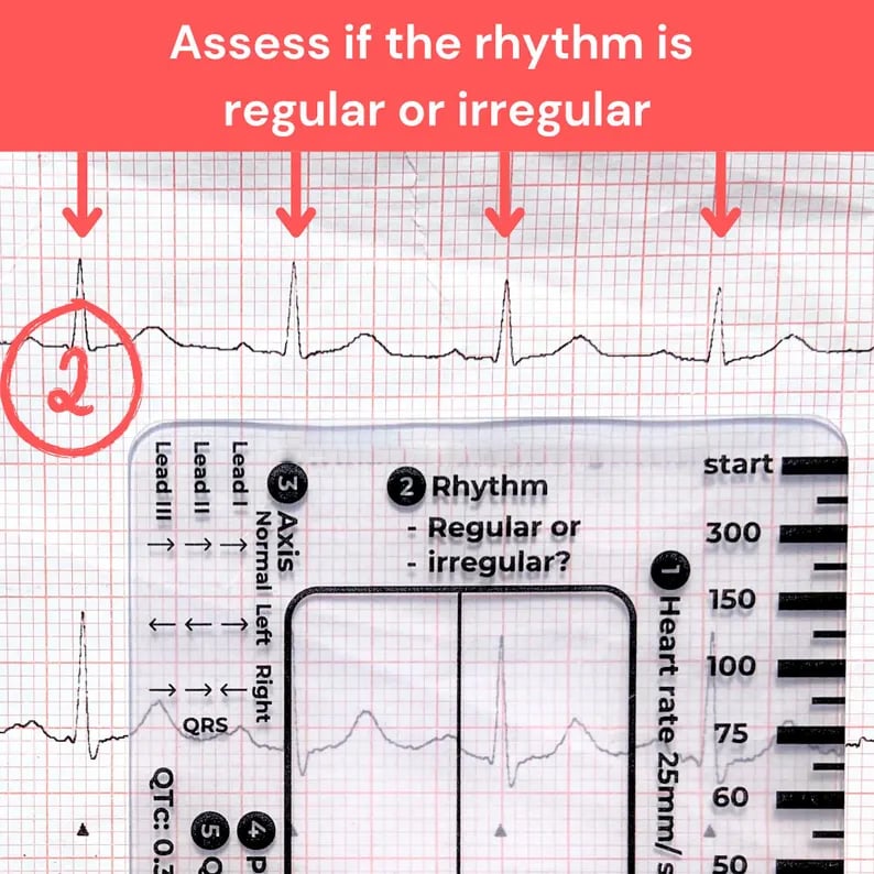 🔥LAST DYAY 49% OFF🔥- ECG 7 Step Ruler