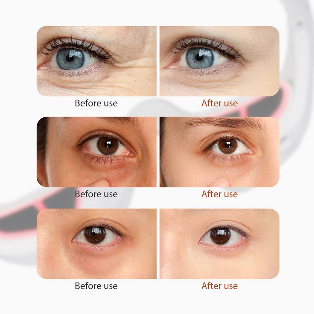 Under-Eye Red Light Therapy Device EMS Eye Massager - image 8