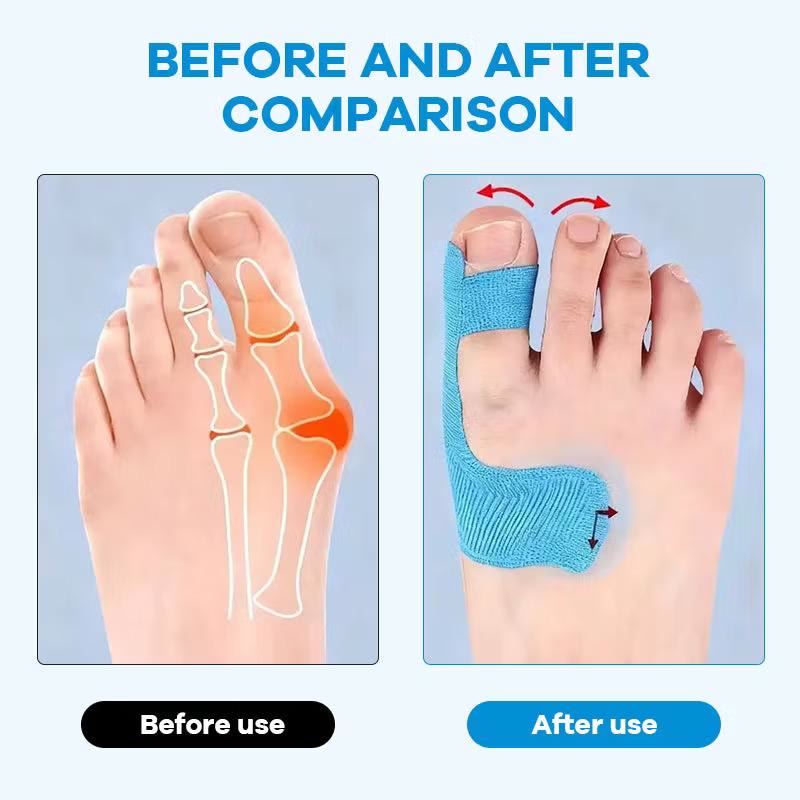 60PCS Pre‑Cut Bunion Corrector Kinesiology Tape, Waterproof Kinesiology Toe Support - image 5