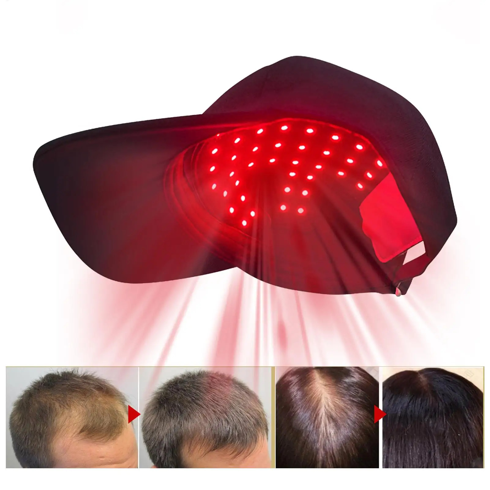 Infrared Hair Growth Cap | Red & Blue Light Therapy Care & Density Sessions - Black - image 1