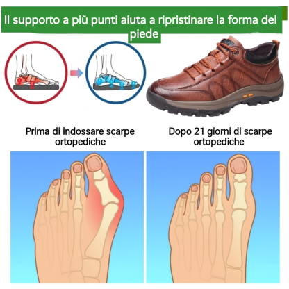 🎁Offerta a tempo limitato🐂 Scarpe ortopediche da uomo, realizzate in pelle di vitello australiana👞 cucite a mano, impermeabili e antiscivolo✅ supporto dell'arco plantare - camminata confortevole