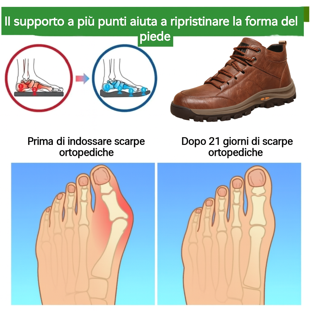 🎁Offerta a tempo limitato🐂 Scarpe ortopediche da uomo, realizzate in pelle di vitello australiana👞 cucite a mano, impermeabili e antiscivolo✅ supporto dell'arco plantare - camminata confortevole