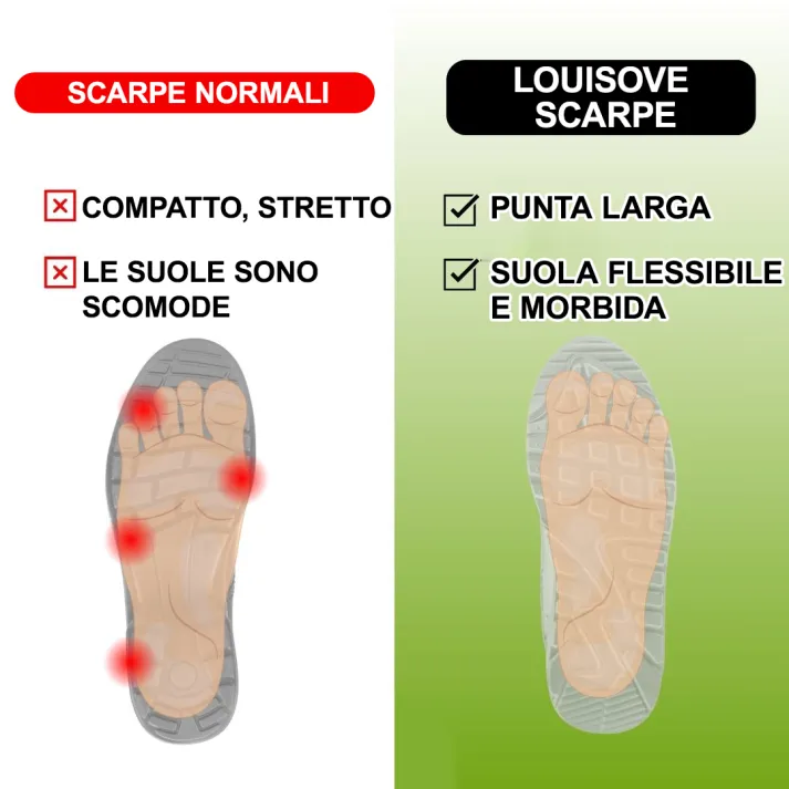 [🔥Oggi metà prezzo: da non perdere] Scarpe ortopediche da donna dal design ergonomico - design con supporto dell'arco plantare👞Sbarazzati facilmente del dolore ai piedi
