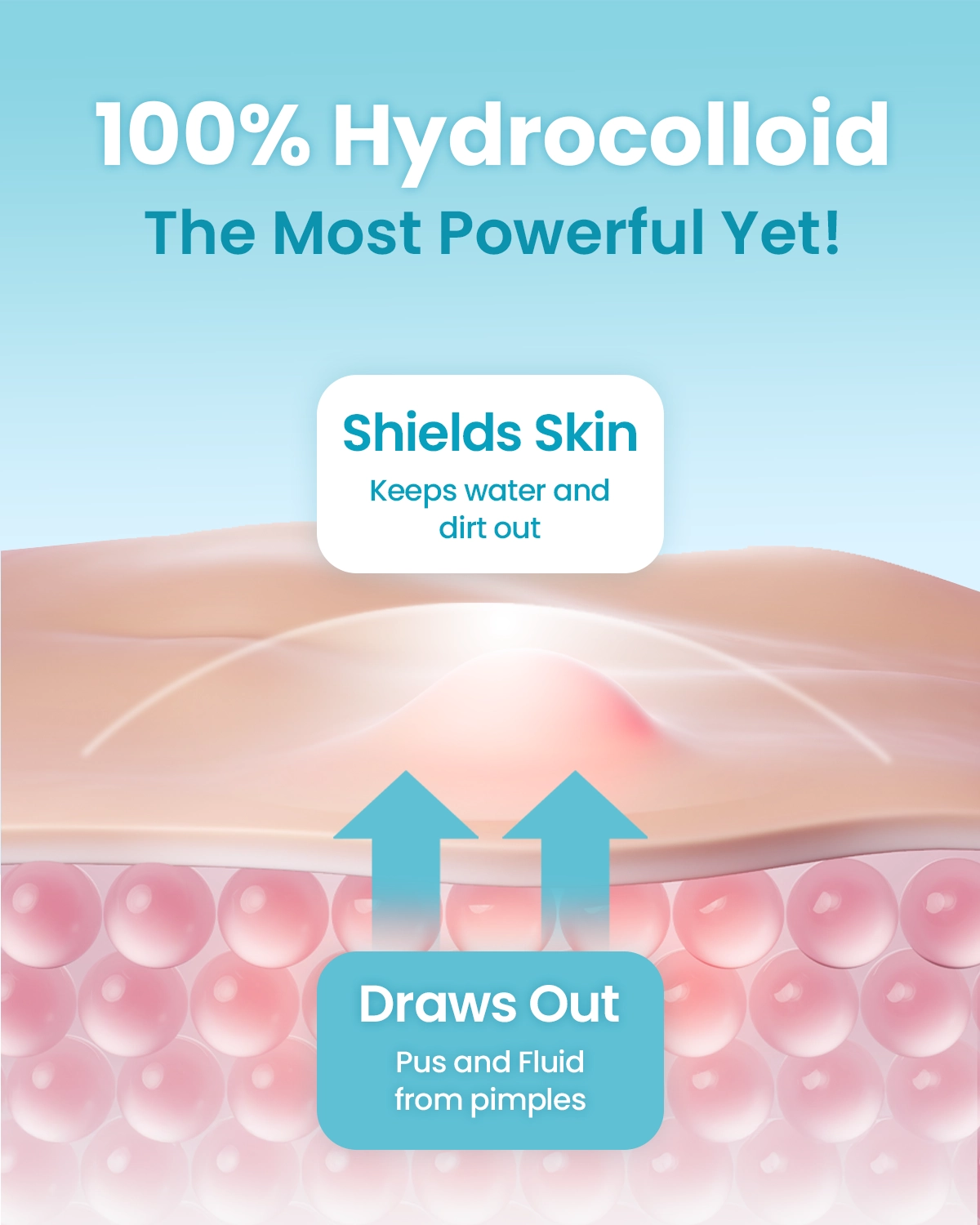 [GLAM UP] Hydrocolloid Blemish Pimple Zit Patches (36 Count/ 2 Sizes)