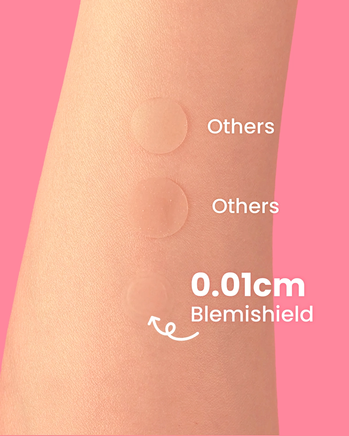 [GLAM UP] Hydrocolloid Blemish Pimple Zit Patches (36 Count/ 2 Sizes)
