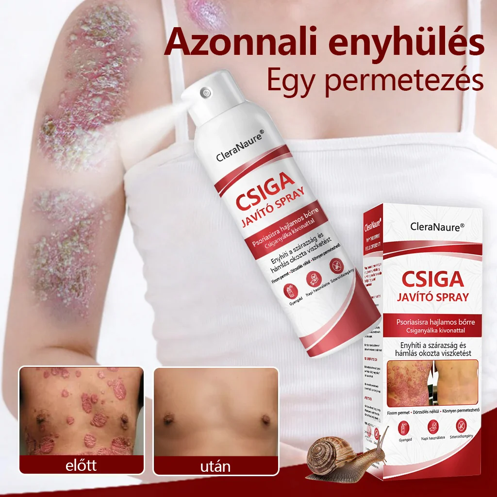 CleraNature® Bálnazsír Spray Viszkető, Hámló Psoriasisra Hajlamos Bőrre