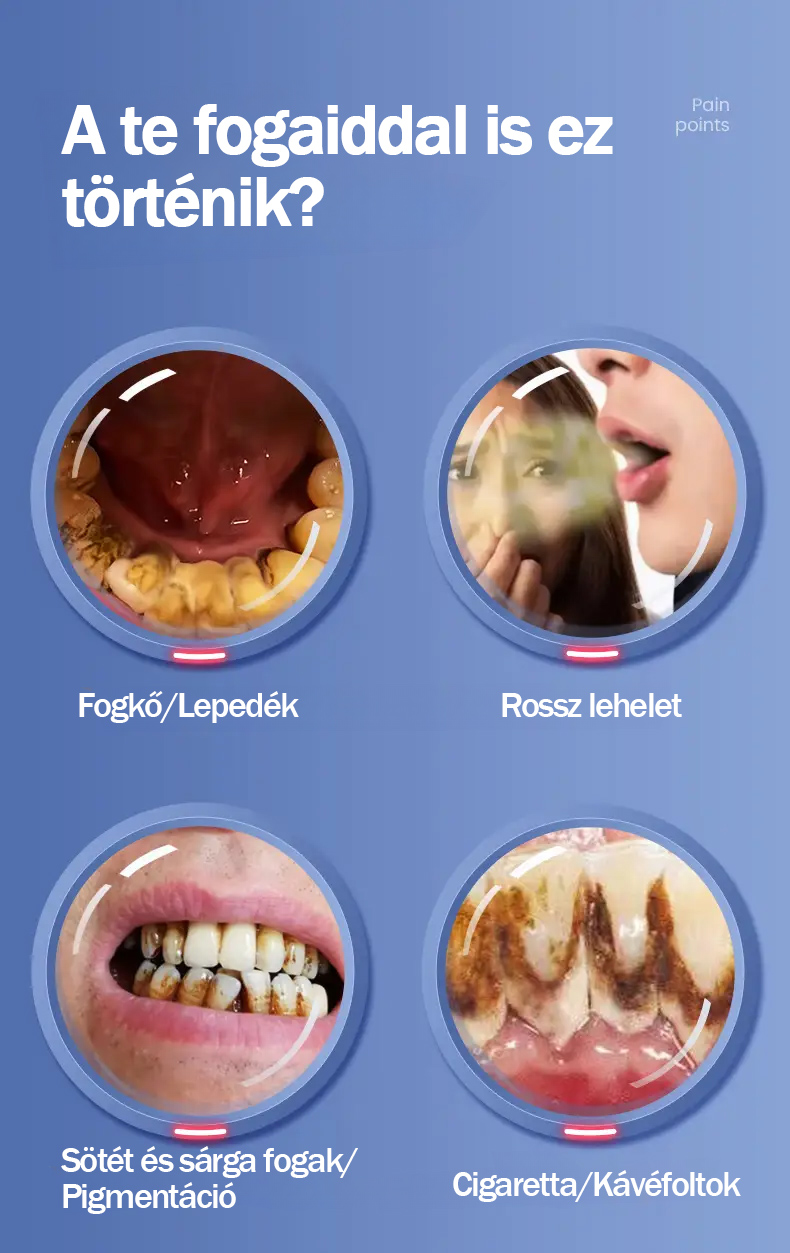 KONKA ultrahangos fogkefe súroláshoz, fogkő eltávolításhoz, füst- és teafoltokhoz, fogtisztításhoz, ajándék barátnőnek, barátnak és férjnek [Zászlóshajó] 5 millió áramlás/perc ultrahangos 2 fúvóka