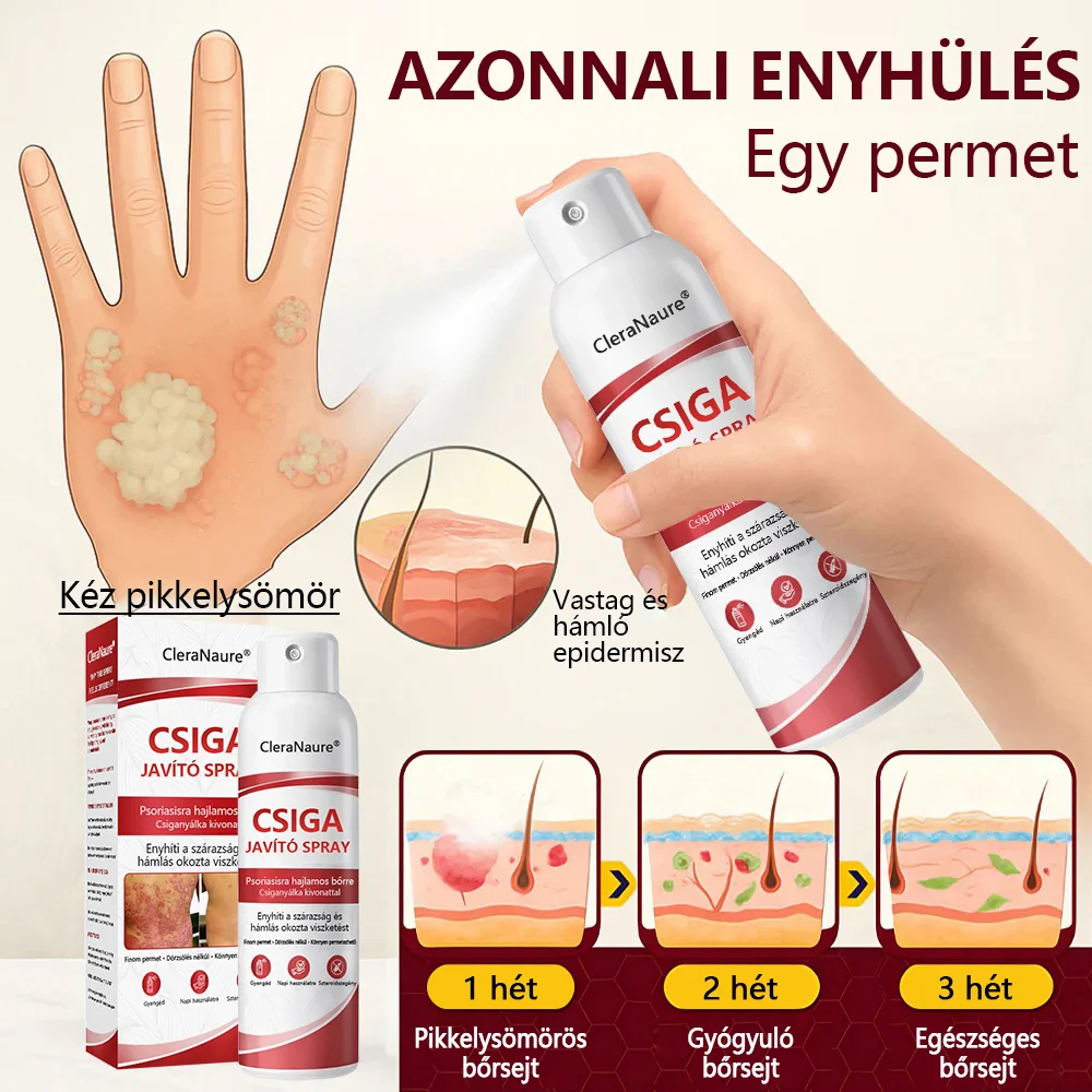 CleraNature® Bálnazsír Spray Viszkető, Hámló Psoriasisra Hajlamos Bőrre
