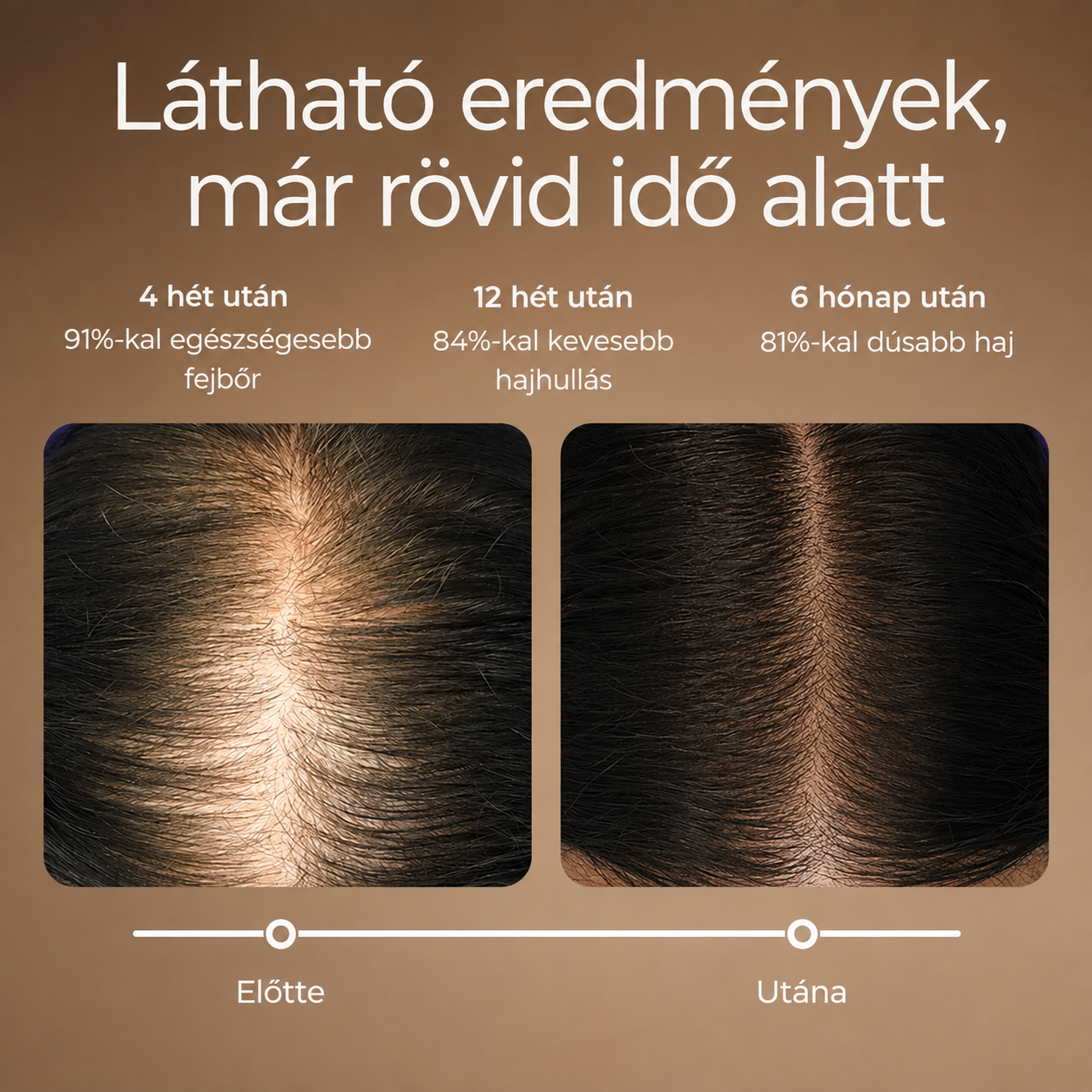Ez a hatékony, FDA által jóváhagyott vörös fényterápiás sapka dúsabbá és egészségesebbé teheti a hajat.