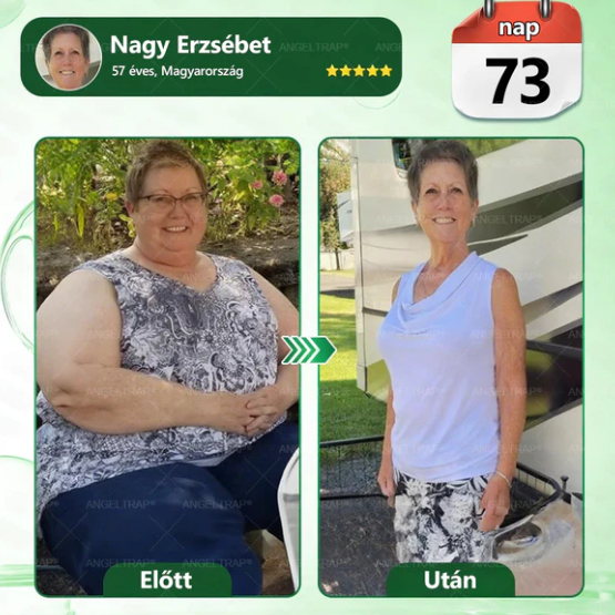 👍ANGELTRAP@Moringa x Berberine xAMPK 10 az 1-ben anyagcsere-támogató nanotűs tapasz (Naponta egy tapasz, 7 napon belül látható változások) HU✅ Különböző állapotok, például elhízás, cukorbetegség, alvási apnoe és emésztési problémák esetén alkalmazható.