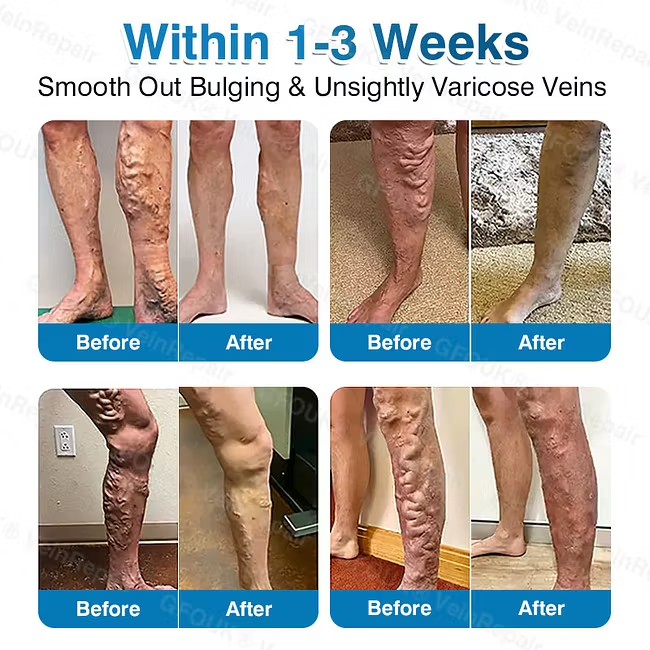 [Copy]✅🇦🇺𝐇𝐞𝒂𝒍𝗿𝗶𝙯𝙚®2 az 1-ben mikrotűs és hidrokolloid tapasz💫