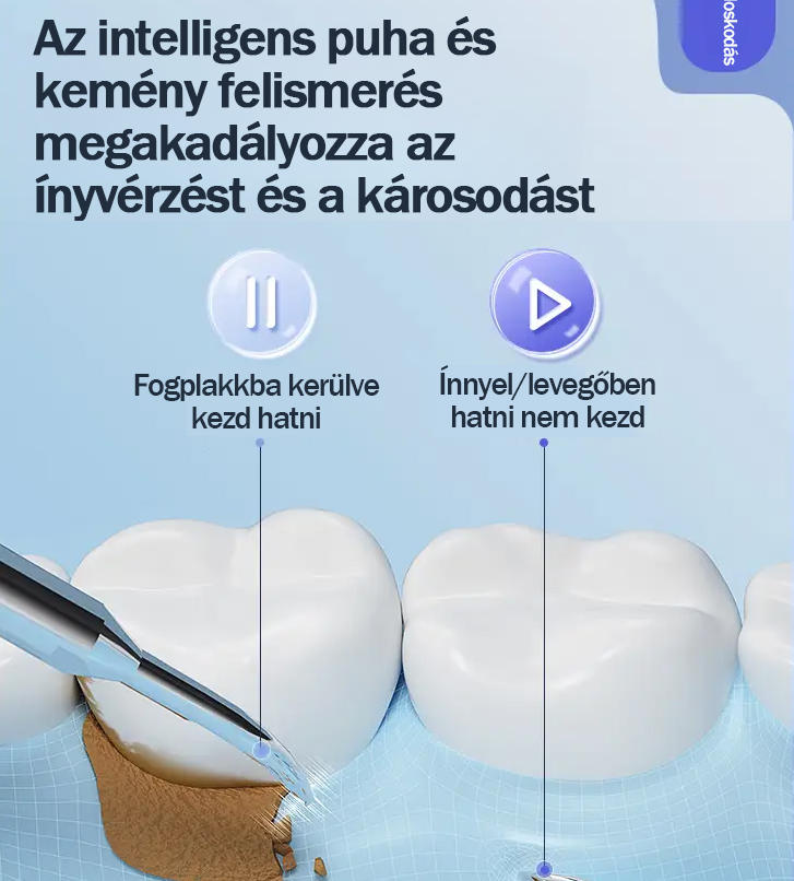 KONKA ultrahangos fogkefe súroláshoz, fogkő eltávolításhoz, füst- és teafoltokhoz, fogtisztításhoz, ajándék barátnőnek, barátnak és férjnek [Zászlóshajó] 5 millió áramlás/perc ultrahangos 2 fúvóka