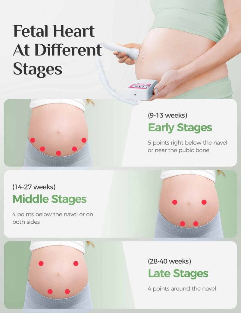 Isupdoppler Fetal Doppler use at home.