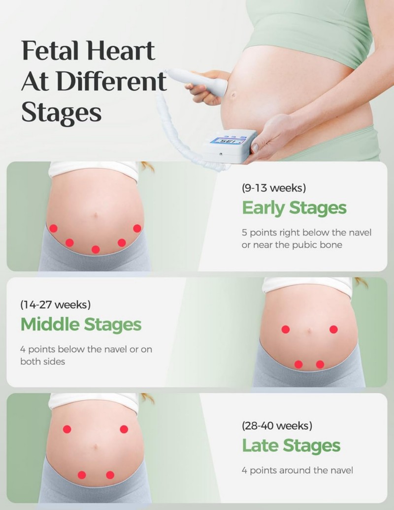 Isupdoppler Fetal Doppler use at home.