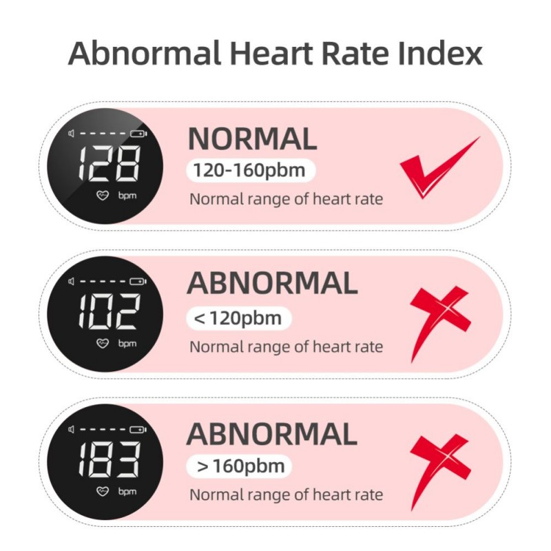 Isupdoppler Fetal Doppler use at home.