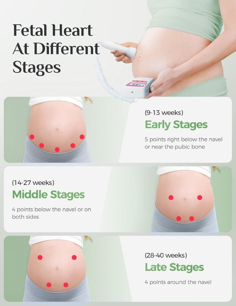 Isupdoppler Fetal Doppler use at home.