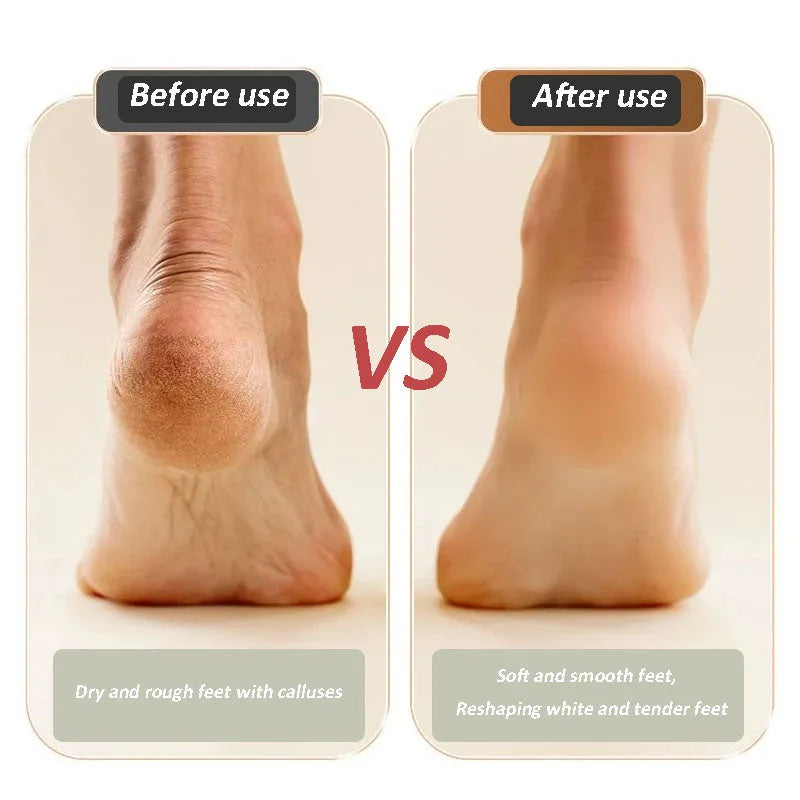 🔥2026 New Arrival💝New Digital Electric Foot Polisher