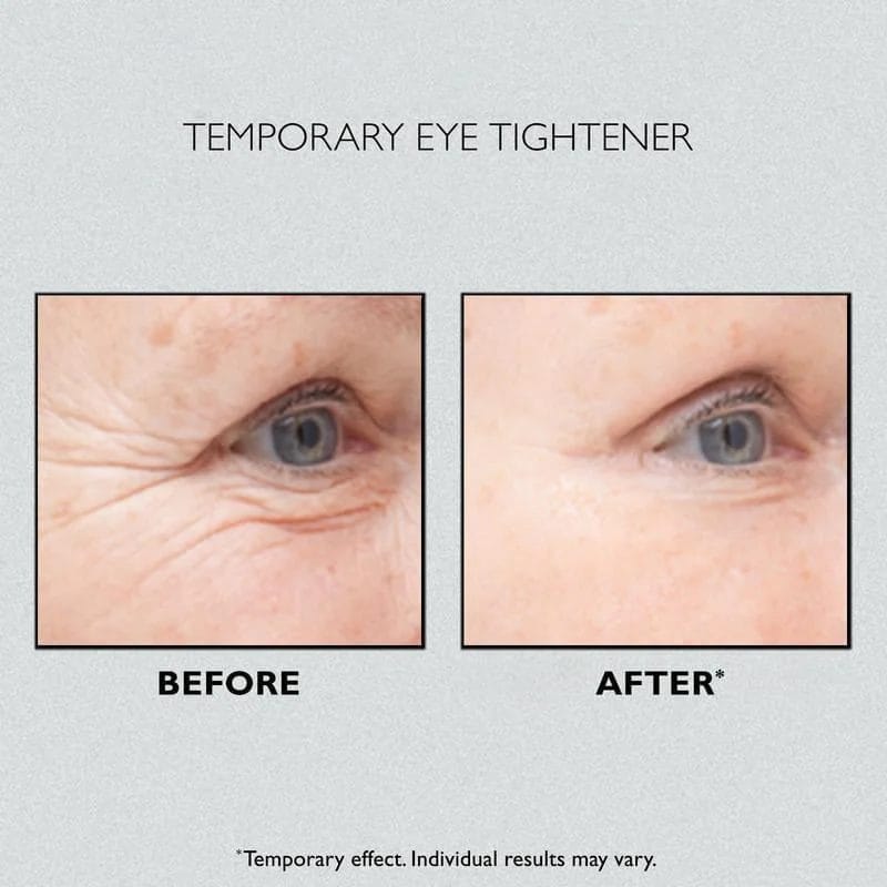 Instant Eye Temporary Eye Tightener