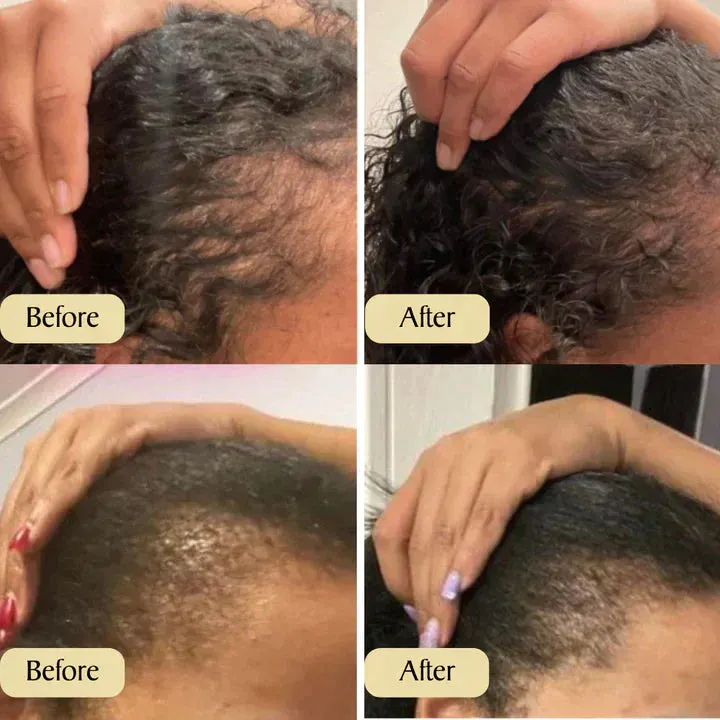 Tiwordnational Hair Oil