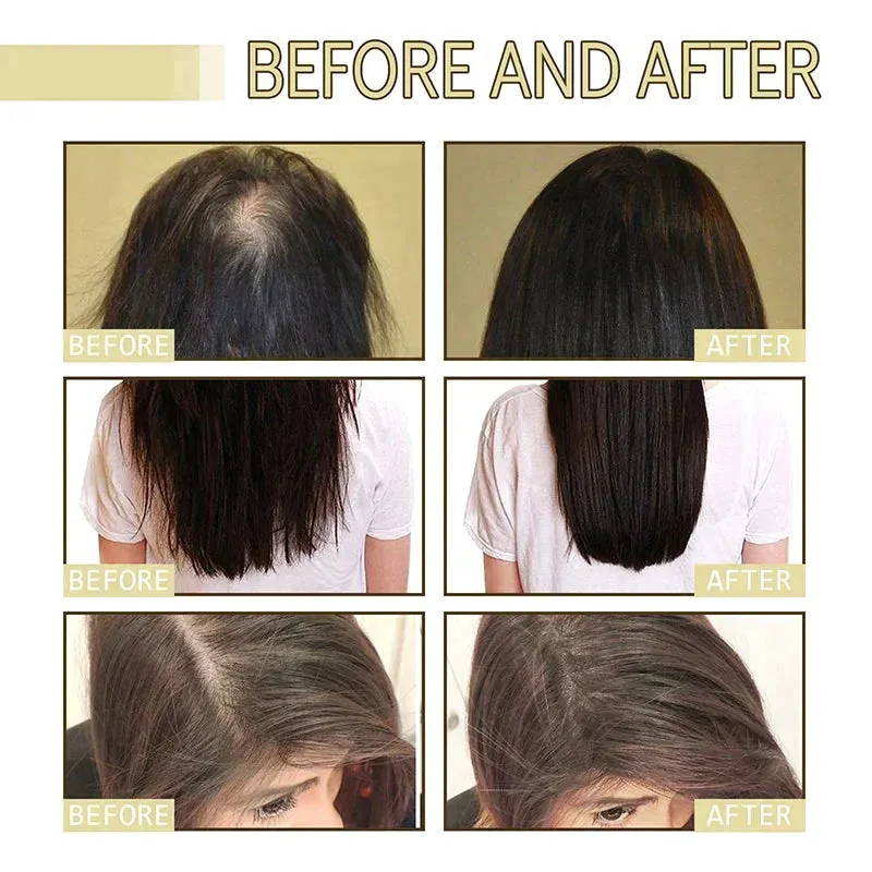 Tiwordnational Hair Oil