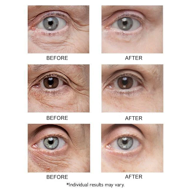 Instant Eye Temporary Eye Tightener