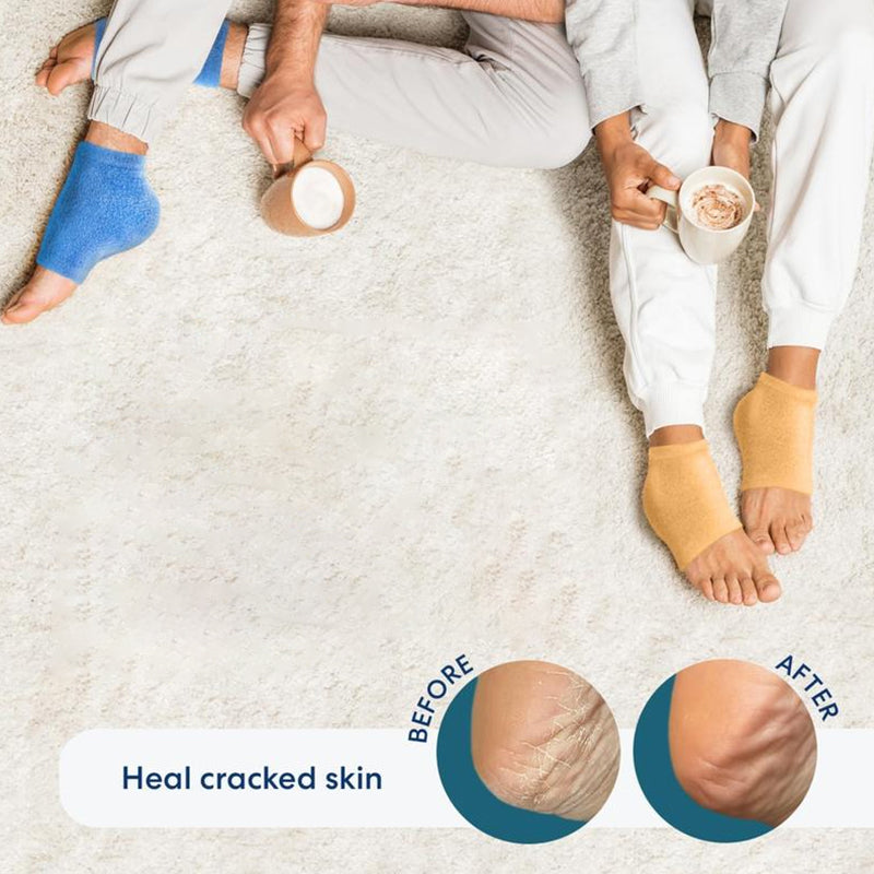 Fuzzy Moisturizing Heel Socks