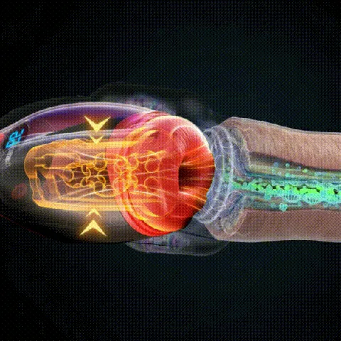 Stage 1 Shockwave Therapy