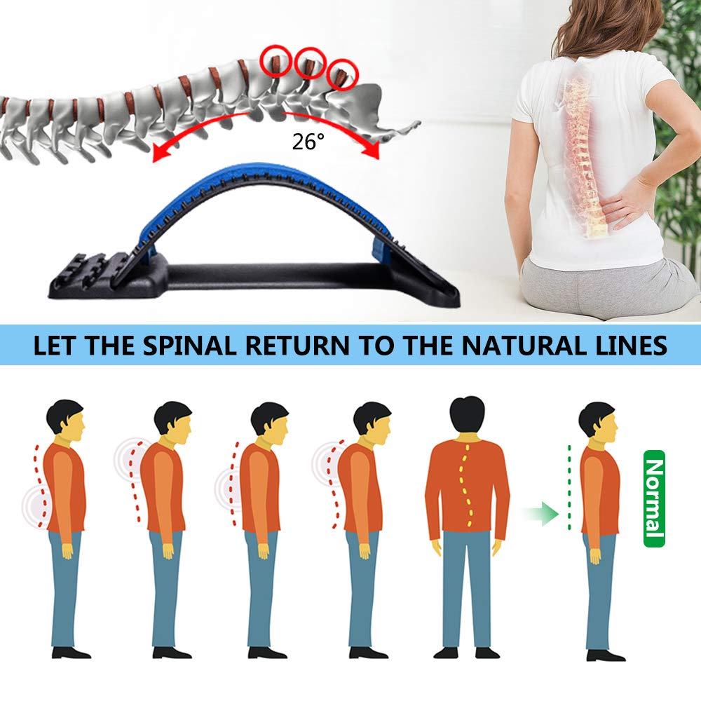 26 Degree Spine Curve Alignment