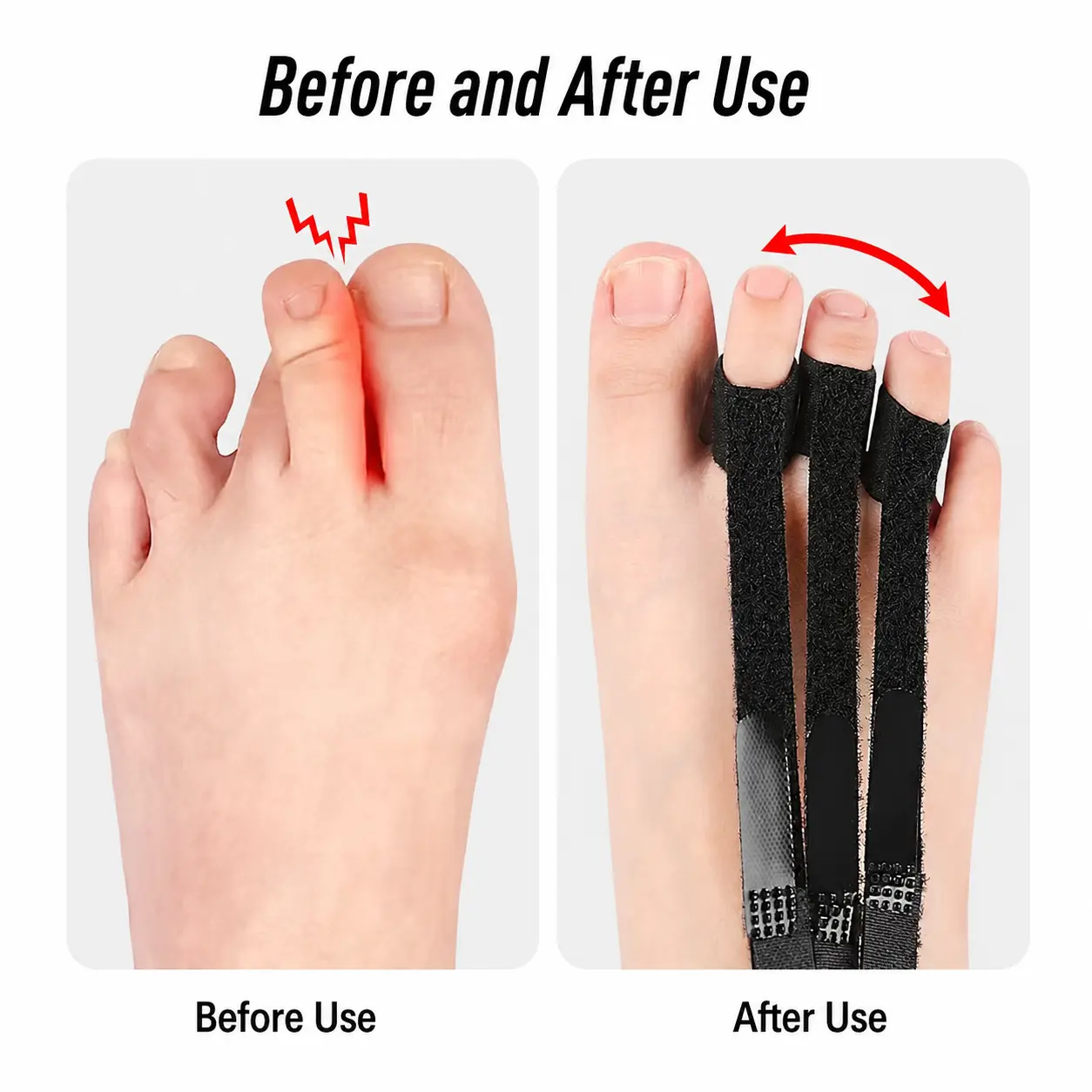 Adjustable Toe Retractor Support for Overlapping Toes & Hammer Toe Comfort