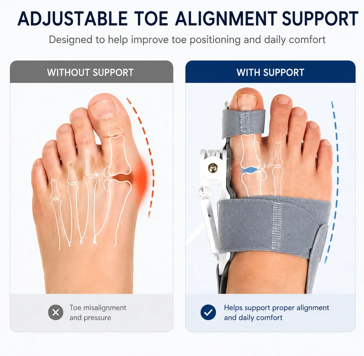 Adjustable Bunion Support Brace with Silicone Cushion