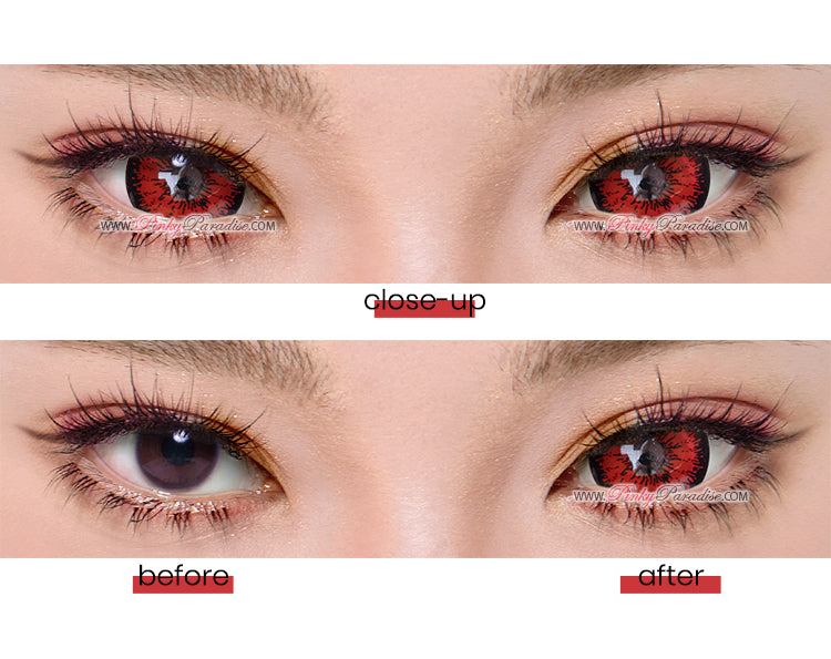 mini sclera red out thumbnail