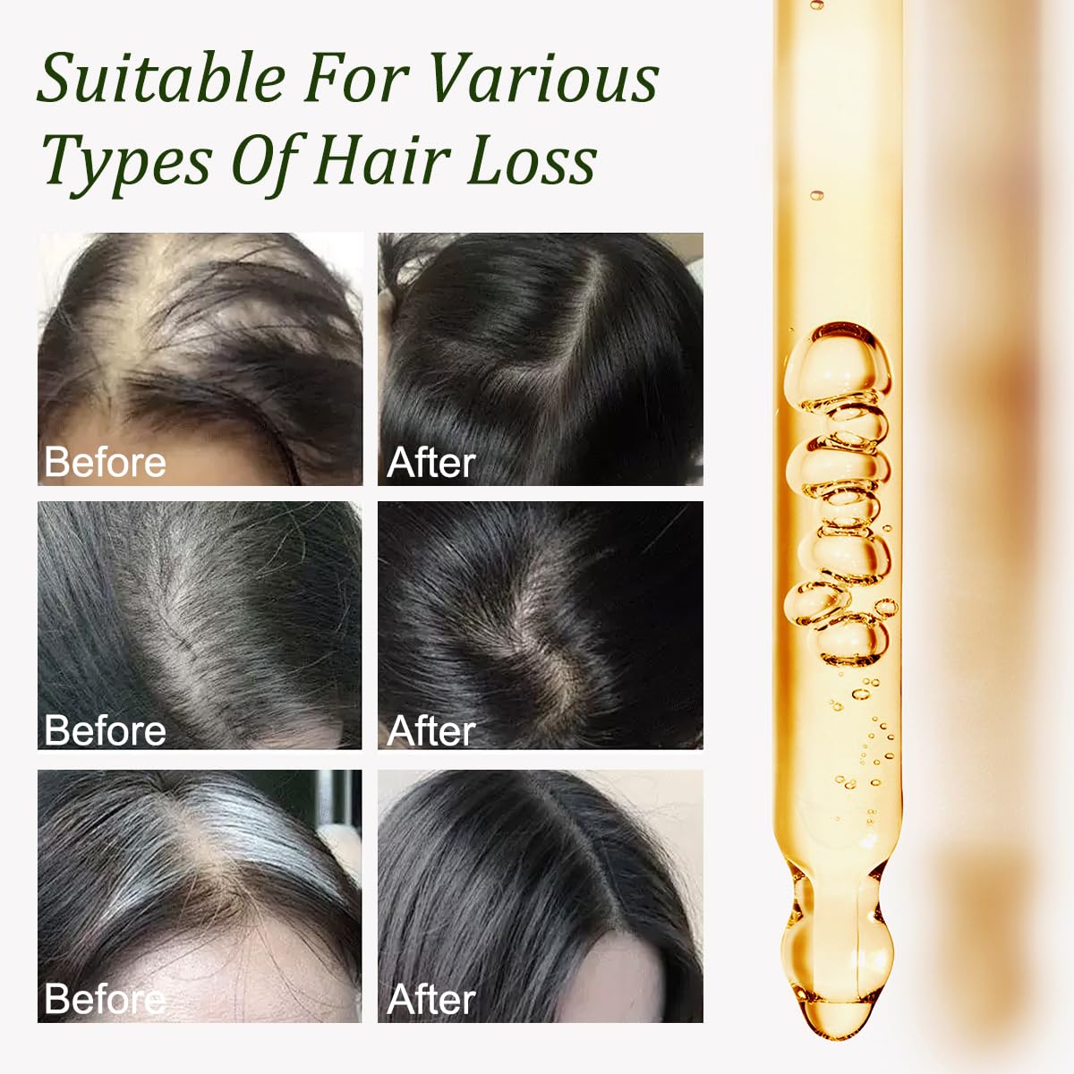 Batana Oil with Rosemary Oil, Natural Hair Growth Serum for Thinning Hair