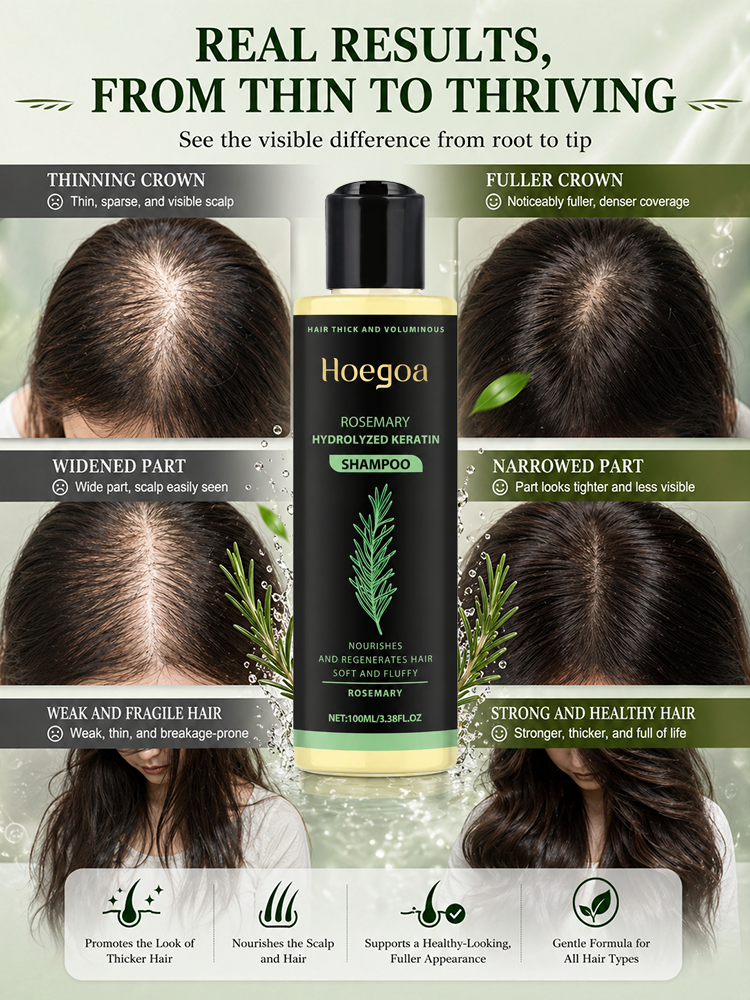 【Hair Loss Fighter - One effective result】 Rosemary Herbal Extract Nourishing and Rejuvenating Shampoo