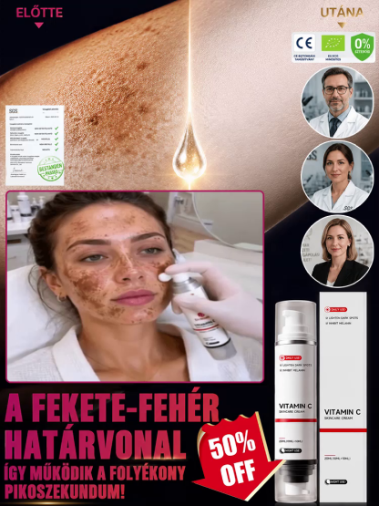 ✨Kettős Hatású Folyékony Lézer Krém - Éjjel-Nappali Pigmentfolt Eltávolító (SGS Tanúsítvány) | 50% KEDVEZMÉNY