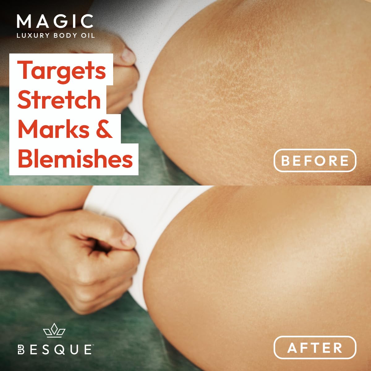 🔥Limited-time discount of 50%🔥Besque Magic Body Oil🌿