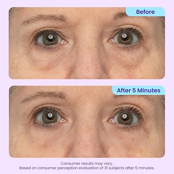 Instant Lift Eye Gel - For the look of Puffiness & Bags, Wrinkles - image 5