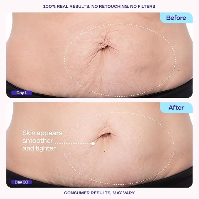 Compact shaping cream - Smooths the abdomen - Moisturizes the skin and reduces fine lines - image 2